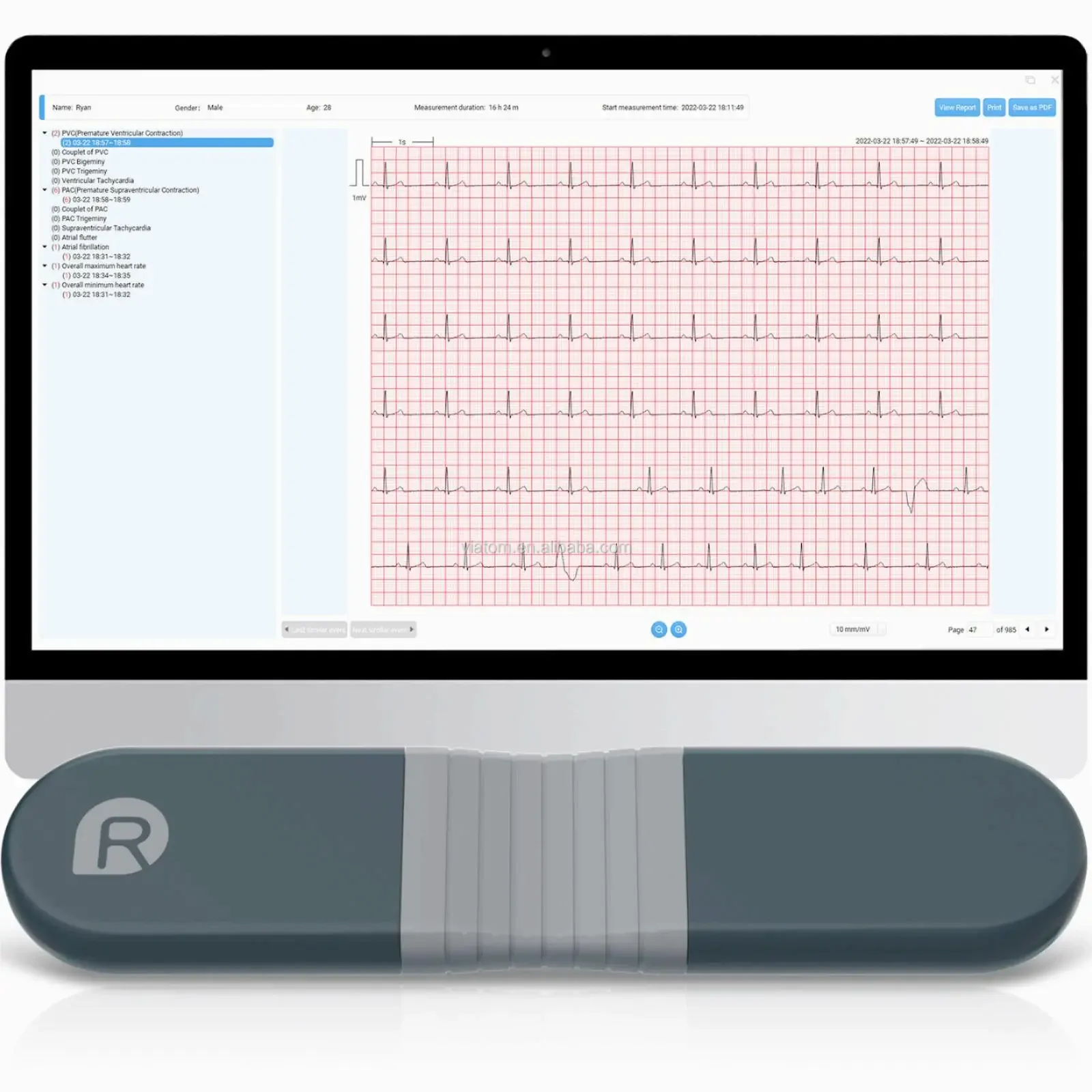 เครื่องบันทึกแบบไดนามิกไร้สายบ - Ecg Patch Monitor บทวิจารณ์และราคา